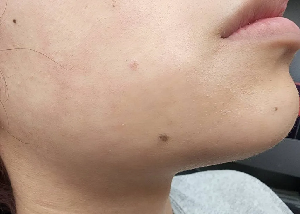 Before